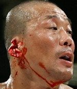 Illustration for article titled Rope Takes Fighters Ear